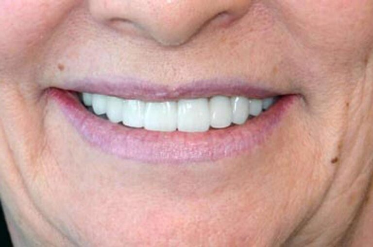 Smile Gallery Ann Arbor, MI New Era Dental