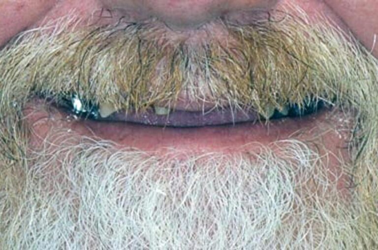 Smile Gallery Ann Arbor, MI New Era Dental