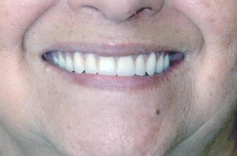 Smile Gallery Ann Arbor, MI New Era Dental