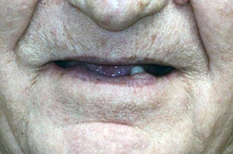 Smile Gallery Ann Arbor, MI New Era Dental