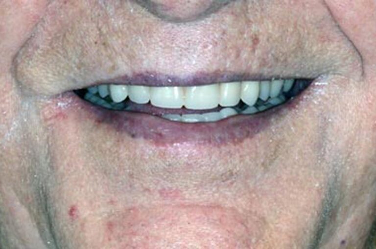 Smile Gallery Ann Arbor, MI New Era Dental