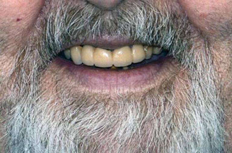 Smile Gallery Ann Arbor, MI New Era Dental