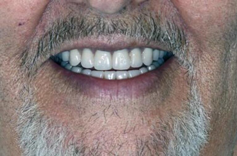 Smile Gallery Ann Arbor, MI New Era Dental