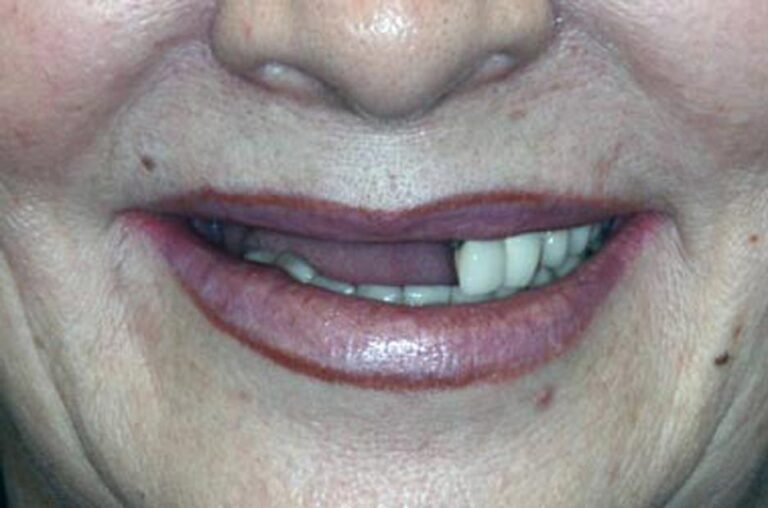 Smile Gallery Ann Arbor, MI New Era Dental